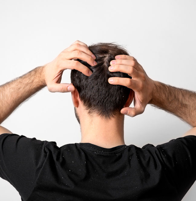 Les solutions efficaces pour limiter la chute et stimuler la repousse